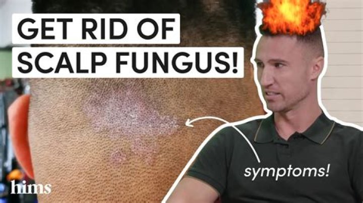 Can you get rid of fungus on a lens?