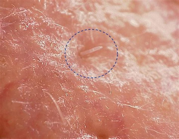 Do humans have mites on their skin?