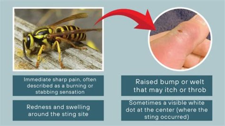 Does a queen wasp sting hurt more?