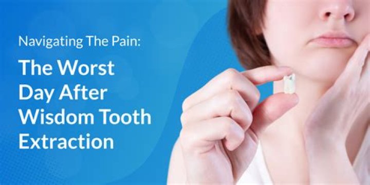 How bad is the pain after wisdom tooth extraction?