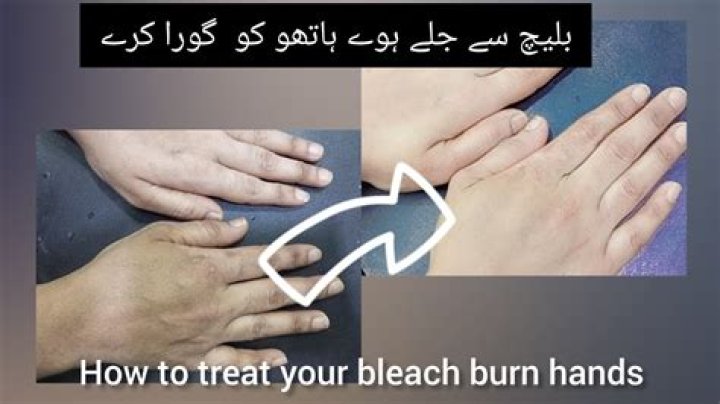 How can I remove excess bleach from my face?