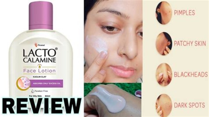 How do you apply calamine lotion to your face?
