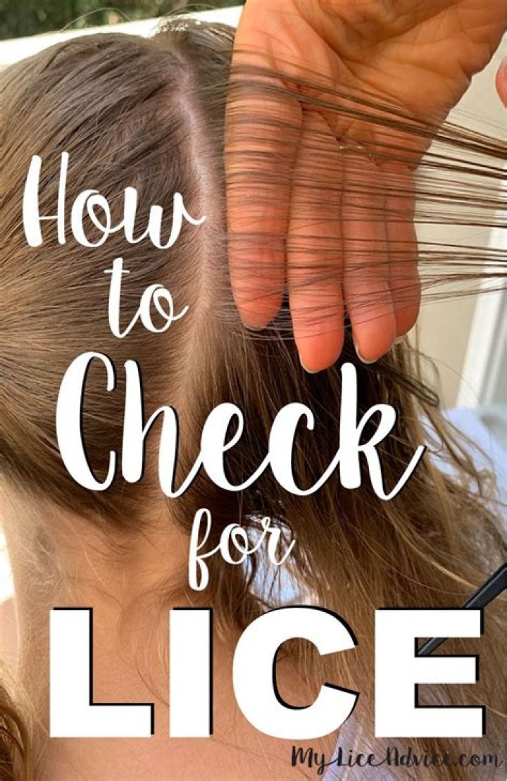 How do you check for lice eggs?