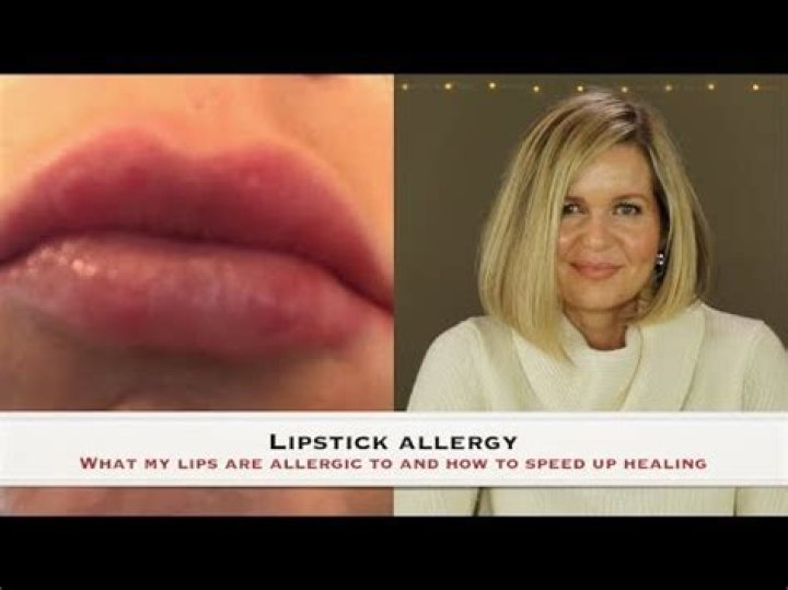 How do you know if you're allergic to lipstick?