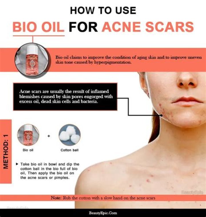 How effective is bio oil for acne scars?