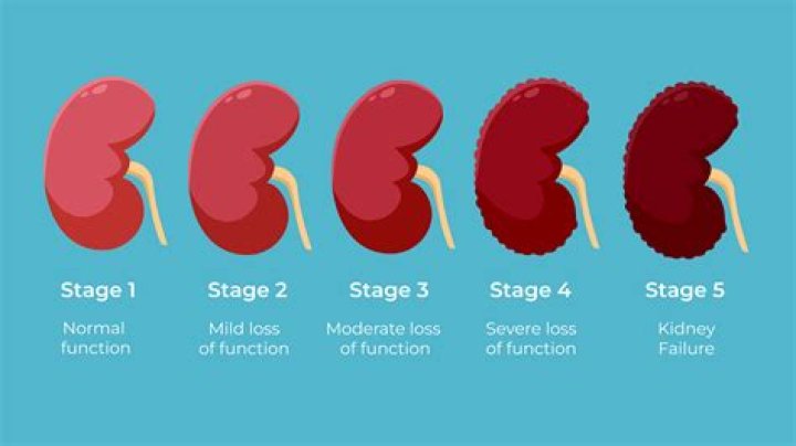 How long can you live with renal failure?