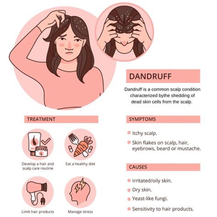 Is Dandruff a sign of yeast infection?