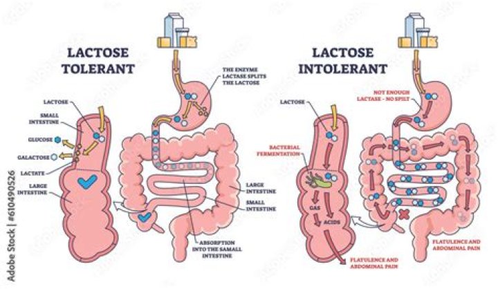 Is Lactose Intolerance a digestive disease?