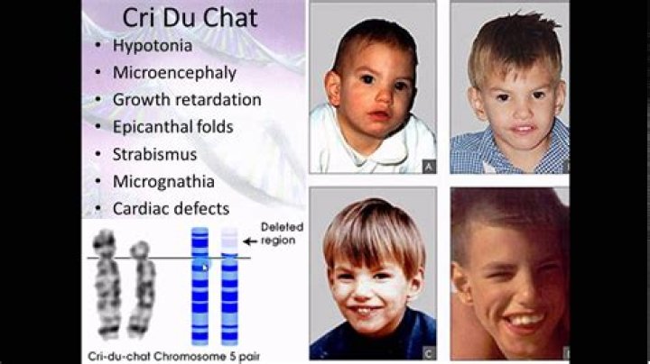 What happens if you have 44 chromosomes?