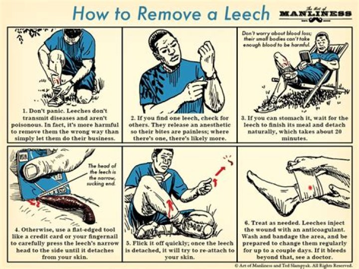 What happens if you pull off a leech?