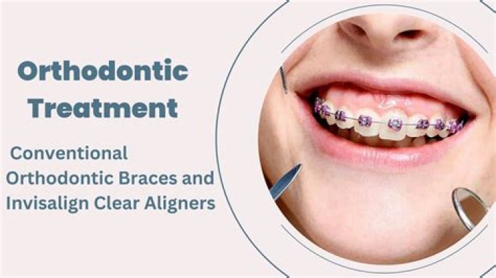What is FMA in orthodontics?