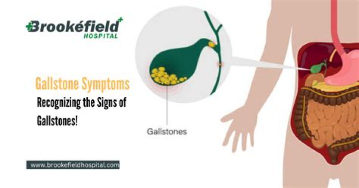 What is gall bladder stone?