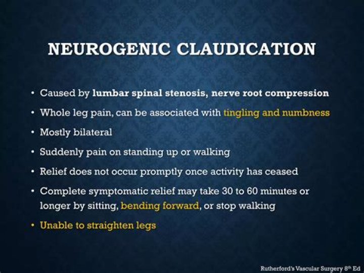 What is neurogenic claudication? | ContextResponse.com