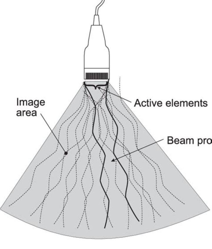 What is phased array probe?