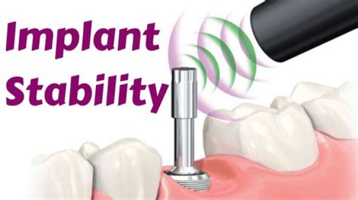 What is primary stability in implants?