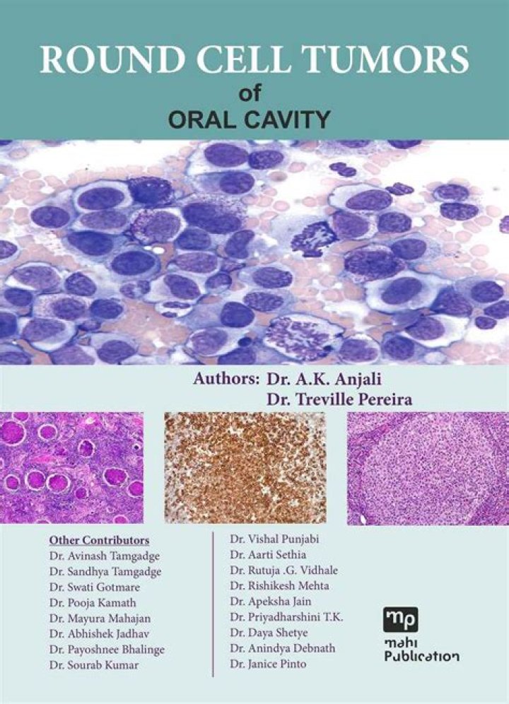 What is round cell tumor?