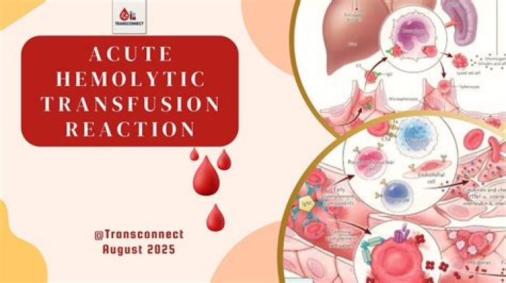 What is the most common cause of severe or fatal transfusion reactions?