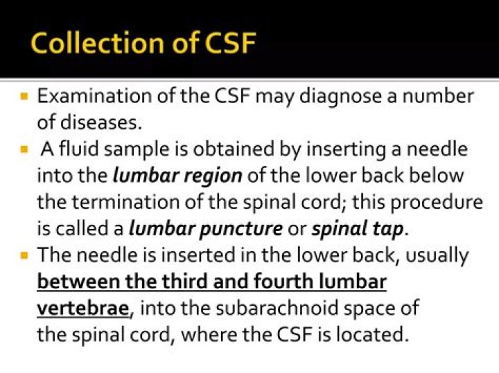 Where is CSF usually obtained for examination?