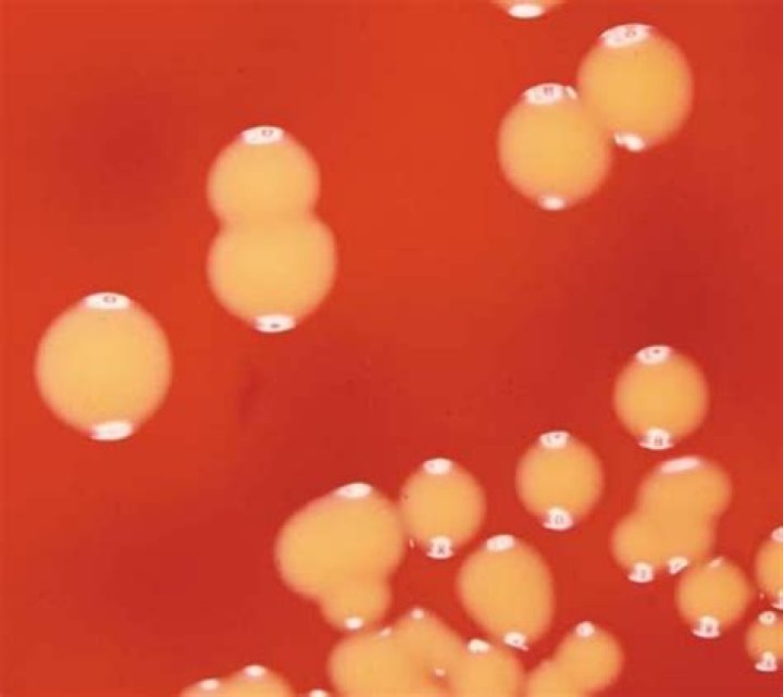 Where is Micrococcus sp found?