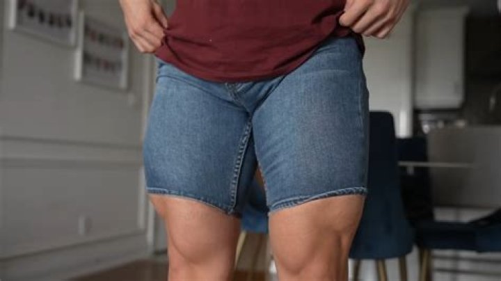 Why are my thighs bruising?