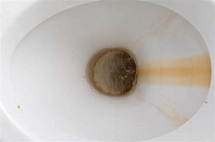 Why does well water stain toilet?